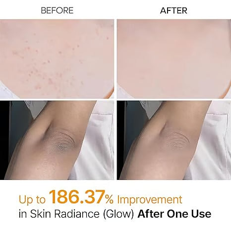 🎁Last Day -49% OFF🌸 New! Peel Shot Keratin Care Kojic Acid Turmeric Spray