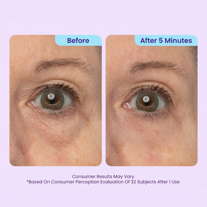 SPECIAL LAUNCH PRICE | Instant Lift Eye Gel | For Puffiness & Bags, Wrinkles, Fine Lines and Dark Circles