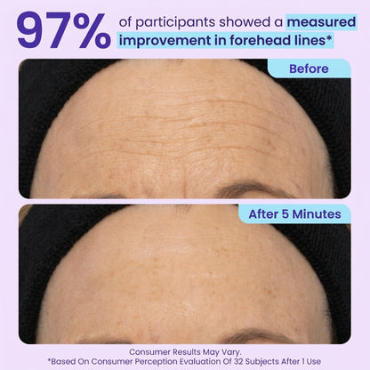 SPECIAL LAUNCH PRICE | Instant Lift Eye Gel | For Puffiness & Bags, Wrinkles, Fine Lines and Dark Circles