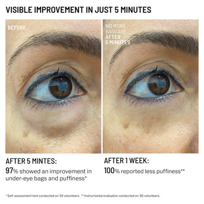 No More Baggage Eye Bag Cream-Depuff, Tighten & Brighten Tired Under-Eyes in Just 5 Minutes