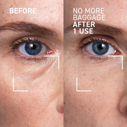 No More Baggage Eye Bag Cream-Depuff, Tighten & Brighten Tired Under-Eyes in Just 5 Minutes