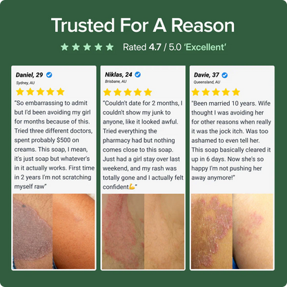 Veloma Antifungal Soap