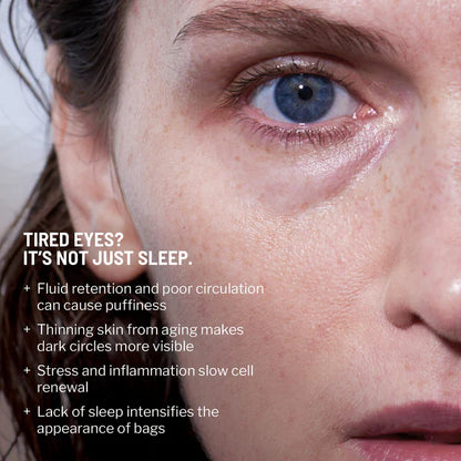 No More Baggage Eye Bag Cream-Depuff, Tighten & Brighten Tired Under-Eyes in Just 5 Minutes