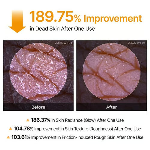 🎁Last Day -49% OFF🌸 New! Peel Shot Keratin Care Kojic Acid Turmeric Spray