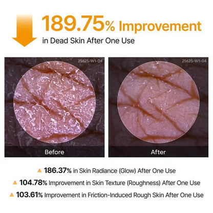 🎁Last Day -49% OFF🌸 New! Peel Shot Keratin Care Kojic Acid Turmeric Spray